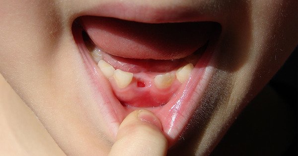 Never Throw Away Your Child's Teeth