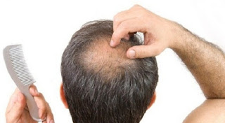 rambut otak tengah rambut otak tengah