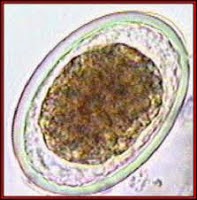 Parasitologi: Ascaris lumbricoides