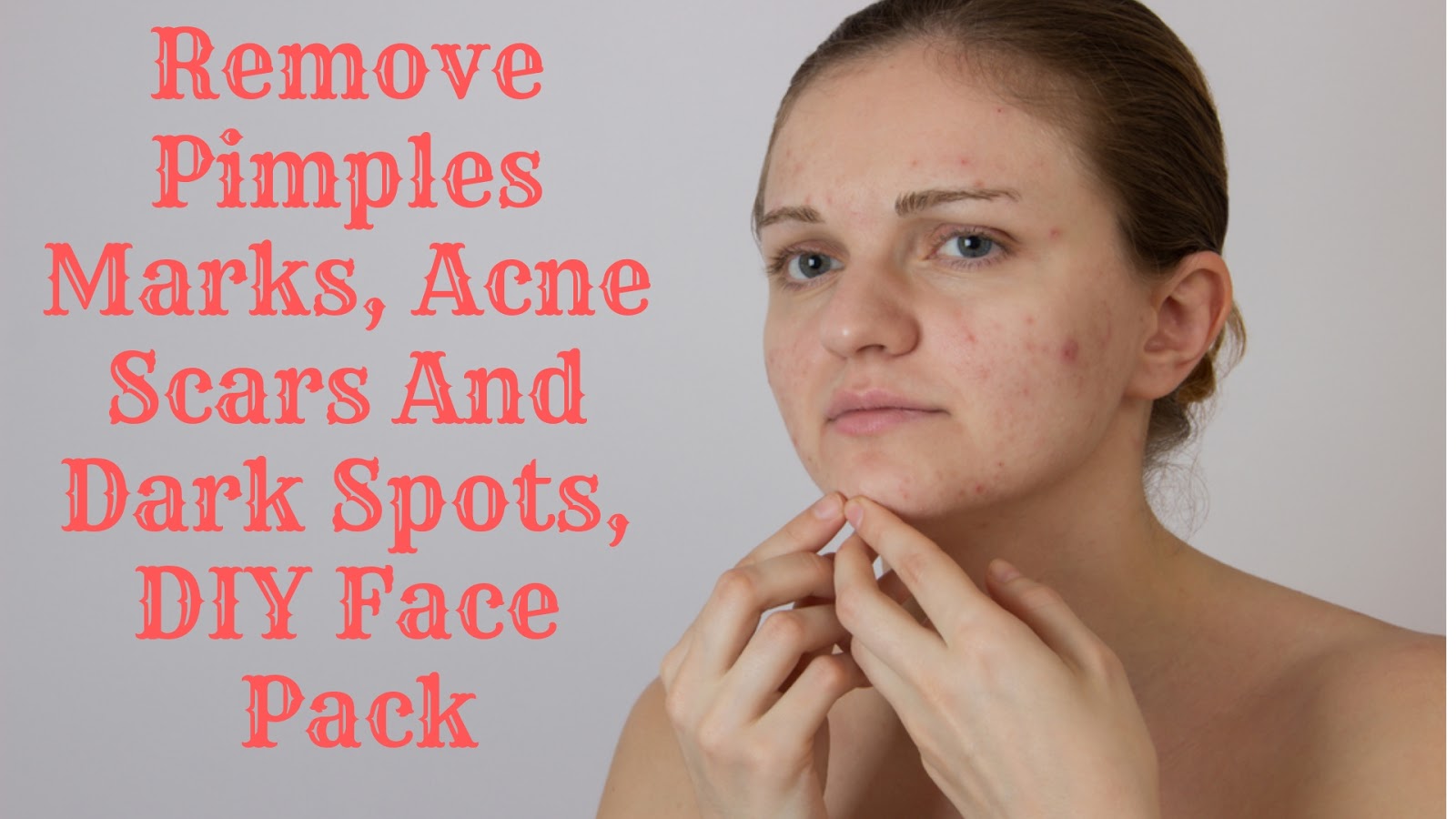 Remove Pimples Marks, Acne Scars And Dark Spots, DIY Face Pack Makeup