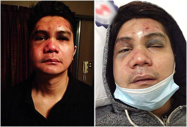 "THIS COMING WEEK VHONG NAVARRO WILL BE ARRESTED!" -- TONY CALVENTO "THIS COMING WEEK VHONG NAVARRO WILL BE ARRESTED!" -- TONY CALVENTO