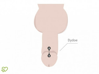 3%2BDydoe - El piercing genital en los hombres -