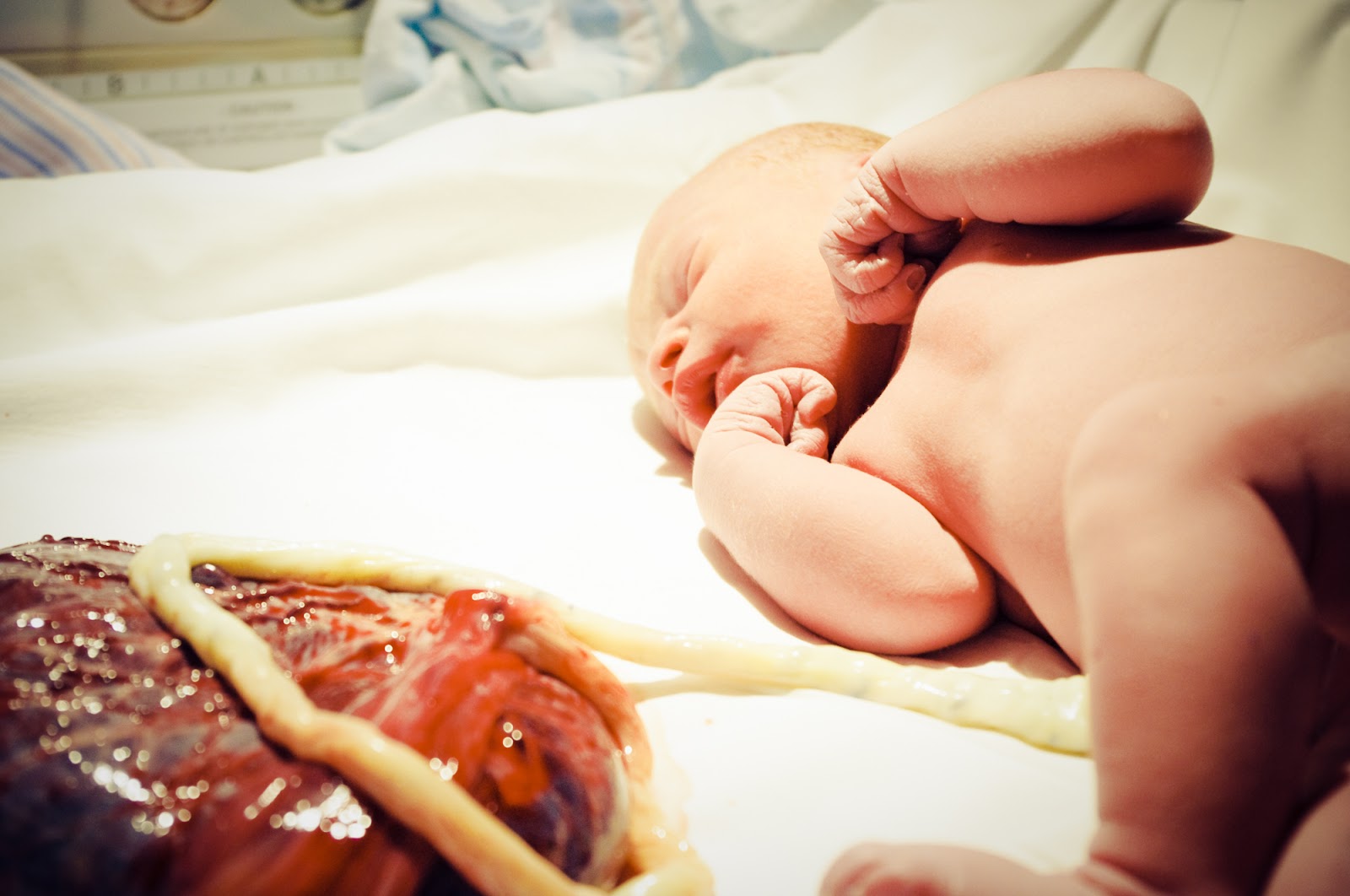 Stemcellportal Placenta Tissue Banking New Way To Harvest Stem Cells