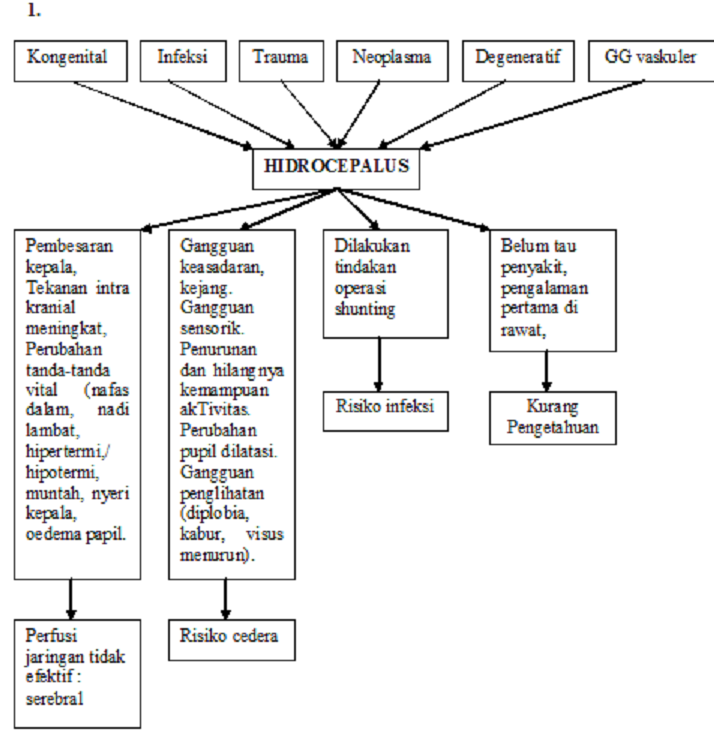 Perawat Hati Askep Anak Hidrocepalus