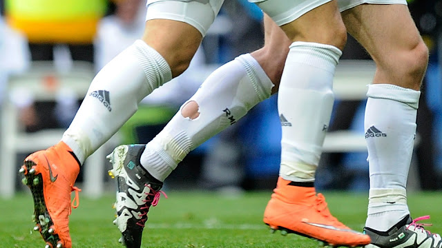 Inilah Daftar 5 Pesepakbola dengan Asuransi Kaki Termahal Inilah Daftar 5 Pesepakbola dengan Asuransi Kaki Termahal