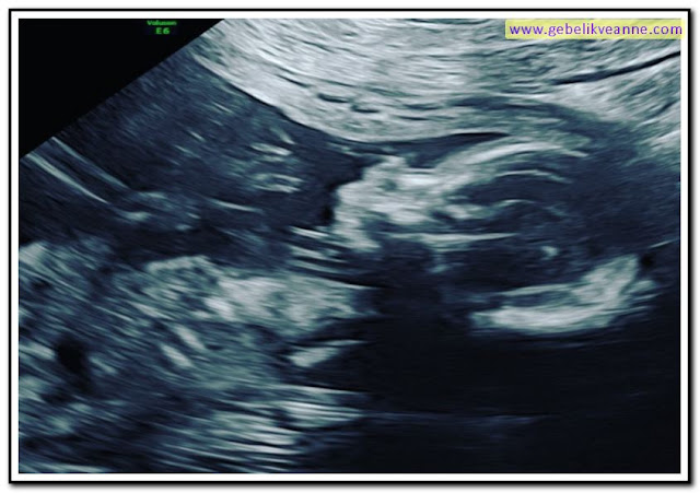 21 haftalık hamilelik (gebelik) 3 boyutlu