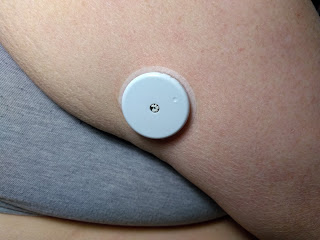 Libre sensor in my arm