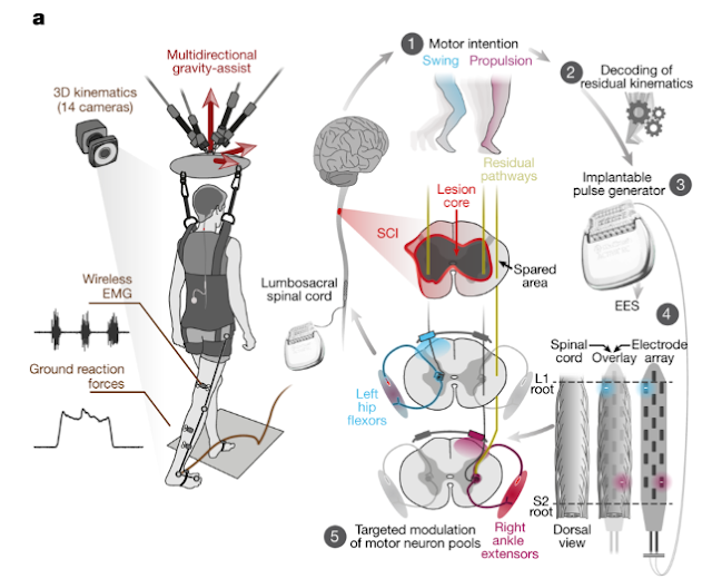 Electrical stimulation of spinal cord can restore partial movement in