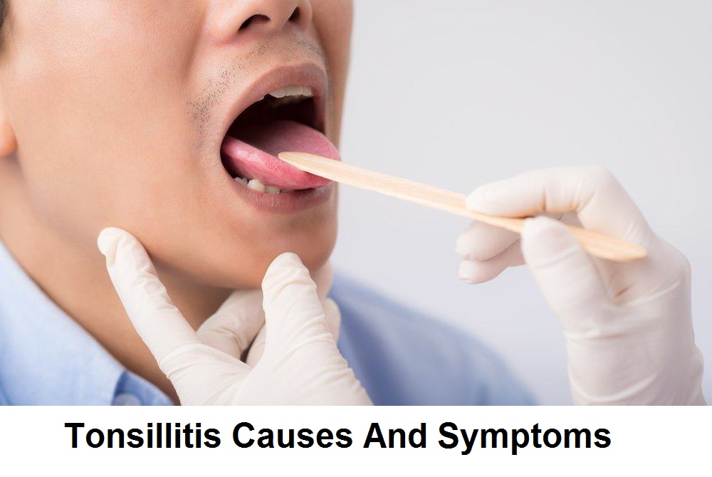 Chronic Tonsillitis Causes And Symptoms Health And Beauty