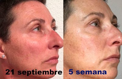 Elisabeth vargas cosmetic, alta cosmética, cosmética profesional, tratamiento regenerador antiaging, tratamiento regenerador antiedad, tratamiento regenerador, 