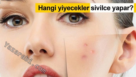 Sivilce Yapan İçecekler ve Yiyecekler