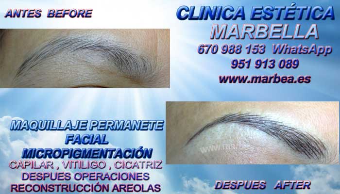 CICATRICES MAMARIA CÓMO REDUCIR CICATRICES MAMARIA DESPUES DE REDUCCIÓN MAMARIA : OFRECEMOS SERVICIO MICROPIGMENTACIÓN MÉDICA CICATRICES, CONOCIDO COMO MAQUILLAJE PERMANENTE CICATRICES MAMARIA