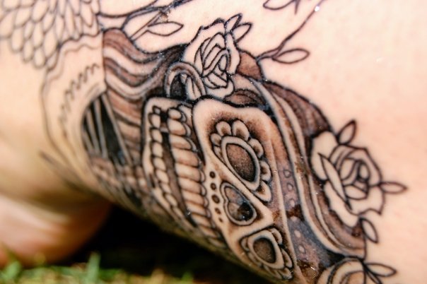 Let Tattoo Removal Season Begin! | Red Deer Laser & Vein Centre | Aurora