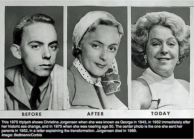 Jorgensen was one of the first people to become famous for undergoing gender transformation surgery. Joregensen served as a clerk in the army before undergoing the surgery in the 50s Jorgensen was one of the first people to become famous for undergoing gender transformation surgery. Joregensen served as a clerk in the army before undergoing the surgery in the 50s
