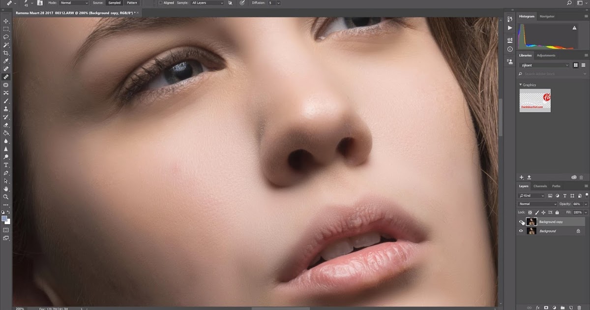 How To Remove Under Eye Bags With IUCN Water