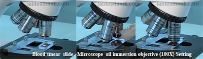 Microscope  oil immersion objective (100X)  Setting