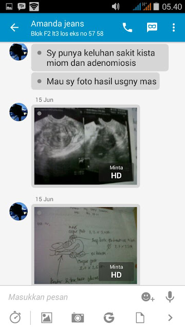 testimoni adenomyosis elifmedika testimoni adenomyosis elifmedika