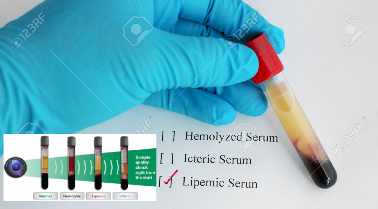 Source MedicalLaboratoryObserver