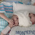 Conjoined Twins Look Stunned to See Each Other for First Time After Being Separated