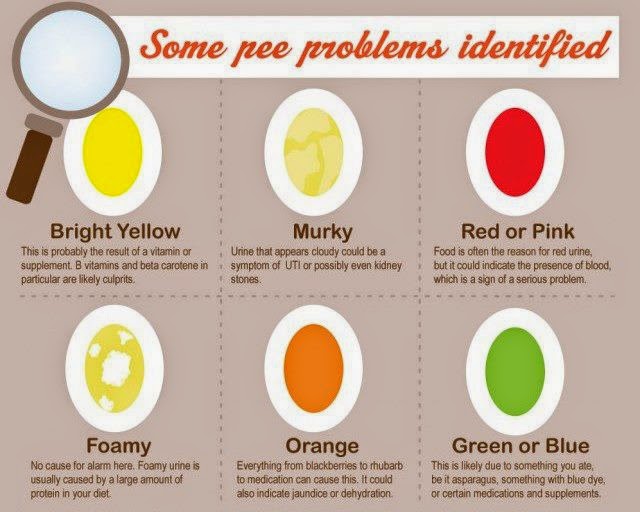 Feses Berwarna Hijau newstempo