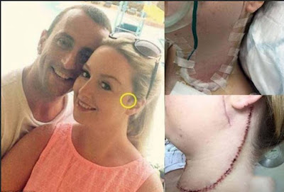 صور|هذا ما اكتشفته هذه الفتاة بسبب الشامة التي على وجهها!