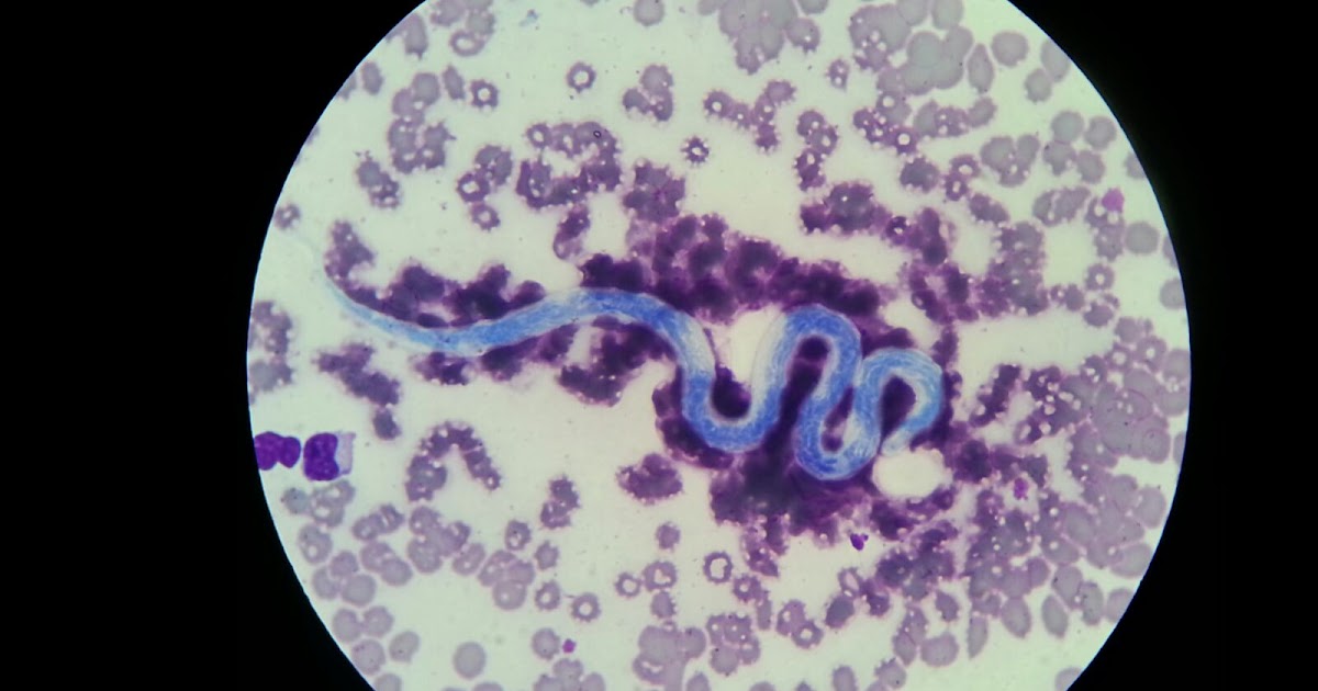 Dirofilariose canina Verme do Coração Consultor Vet