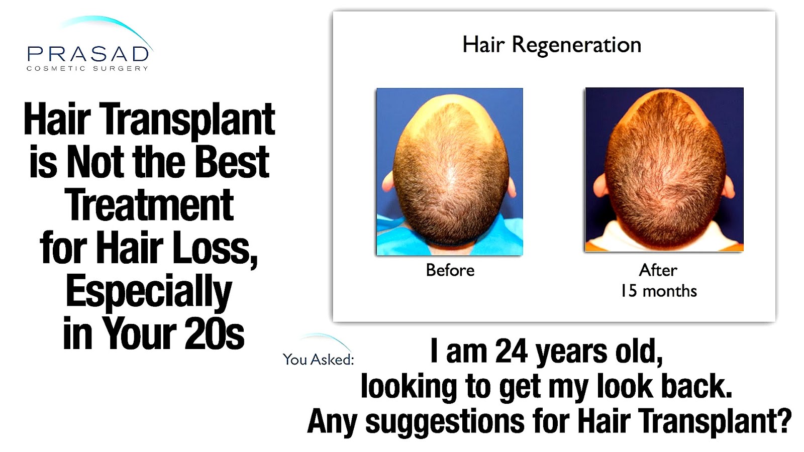 Side Effects Of Hair Transplant Effect Choices