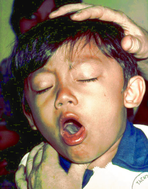 Approach to a patient with cough or difficulty in breathing a patient with cough