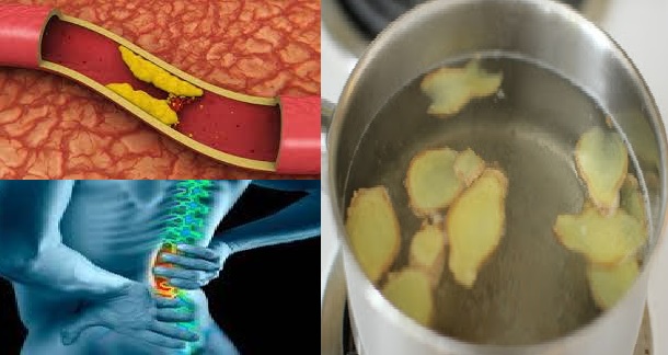 BUKTIKAN...!! Dalam Sekejab Kolesterol Turun 100%, Sakit Pinggang Anda Akan Hilang Total Dengan Resep Alami ini,Tolong Sebarkan.