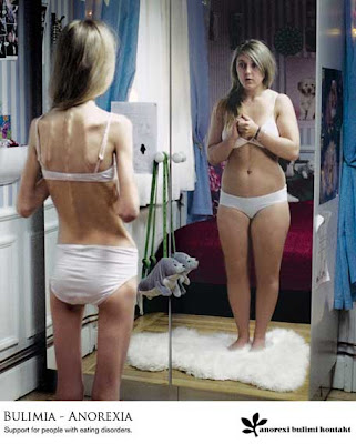 anorexic ass Saved By Grace