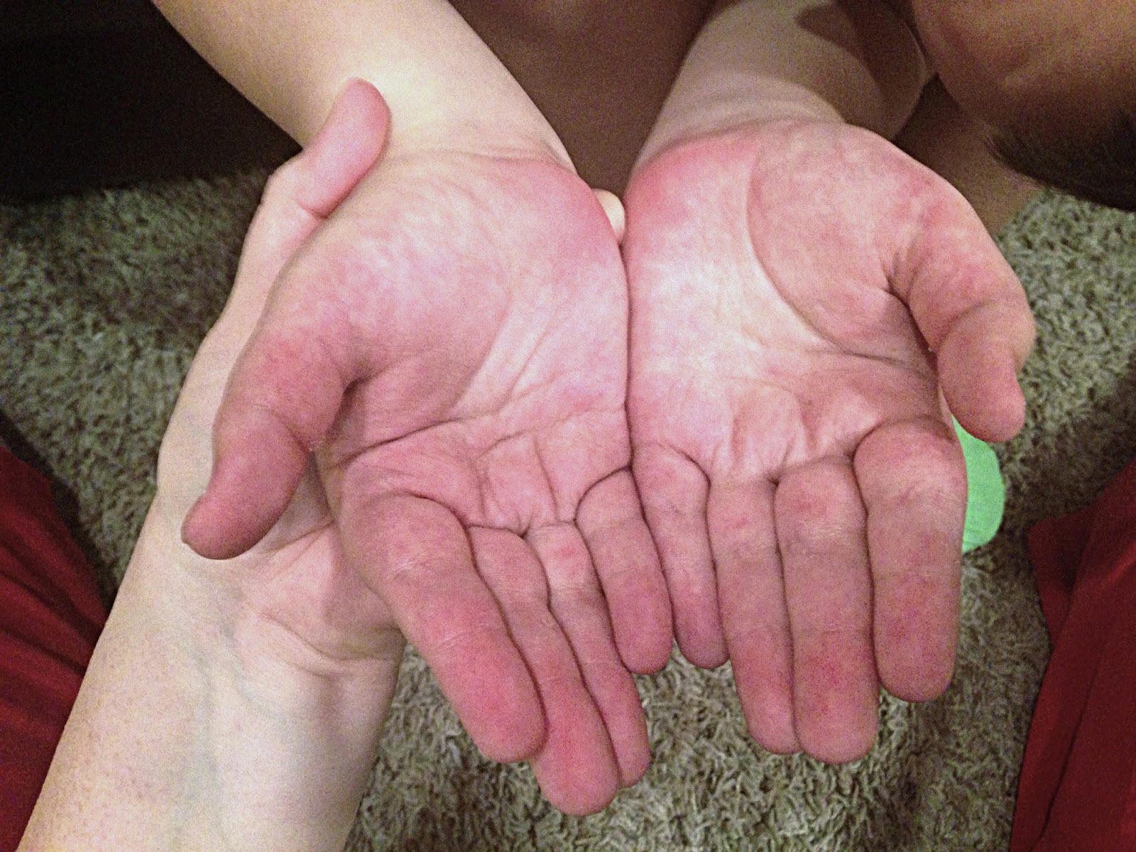 Leukemia Just a Fork In Our Road Sad Feet