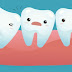Mọc răng khôn đau trong bao lâu thì hết?