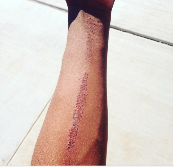 Check out the dangerous 'Eraser Challenge' kids are trying out on