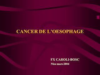 CANCER DE L’OESOPHAGE