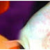 WARNING: SHE WAS INFECTED WITH HIV BECAUSE OF THIS TREATMENT THAT MILLIONS OF WOMEN DO EVERY DAY!