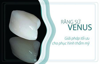 Răng sứ Venus có thể dùng tới hơn 10 năm