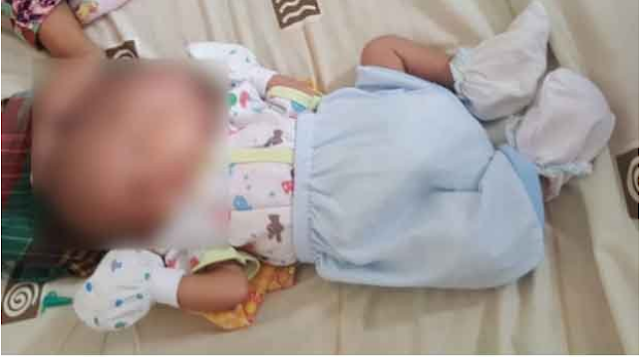Malang Nasib Bayi Berkepala Dua ini, Bukan Mendapat Perawatan Malah Tergeletak Dikontrakan