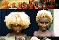 Black Kids Born With Blonde Hair Quaebella