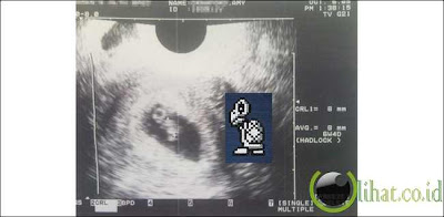 Penyu Daya Penyu Daya