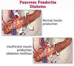 Manfaat Tahitian Noni Untuk Penyakit Diabetes
