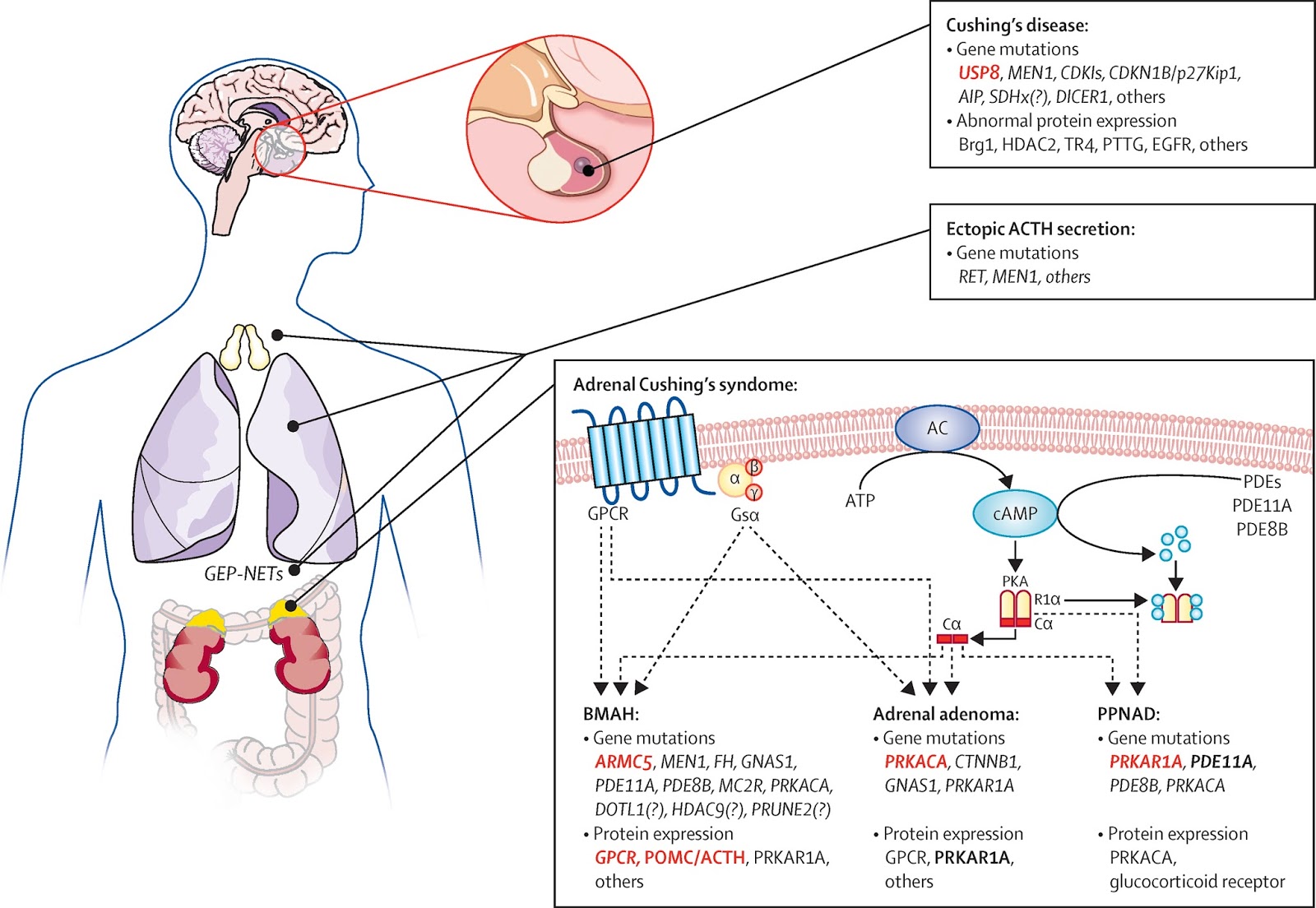 Rajibsman Cushing syndrome