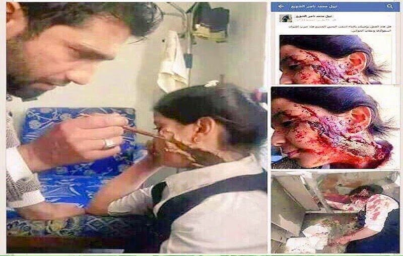 Ahli Make Up Iran Ubah Bocah Gadis Jadi ‘Korban Serangan Saudi’