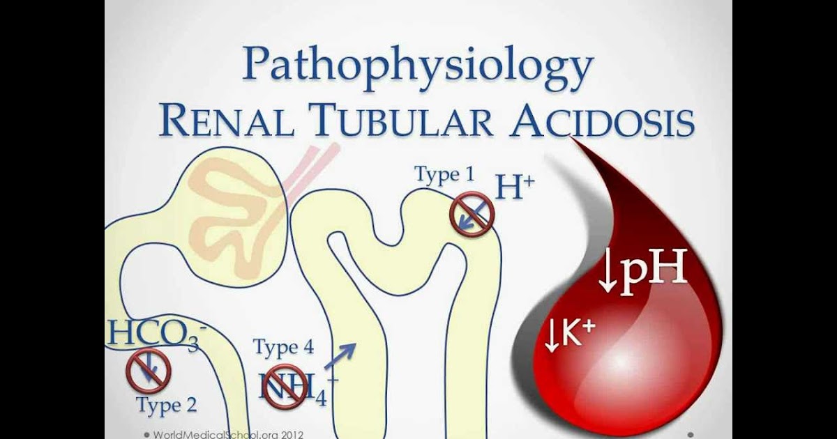 Asidosis Metabolik Belajar Ngeblog Sambil Berbagi