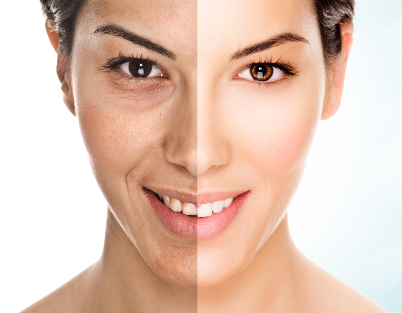 anti aging women