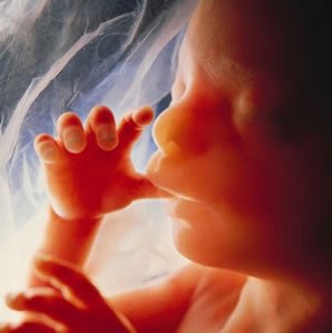 gestação sexo do bebê, gravidez, Gui Mazzoni, malformação, Mamãe Gatona, Nasceu uma Mãe, segundo trimestre, Ultrassonografia