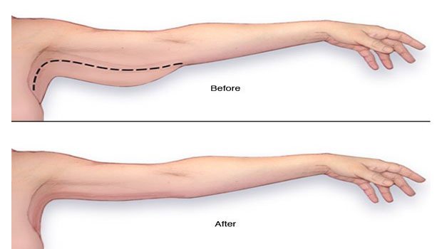 Reducir la grasa del abdomen hombres image 10
