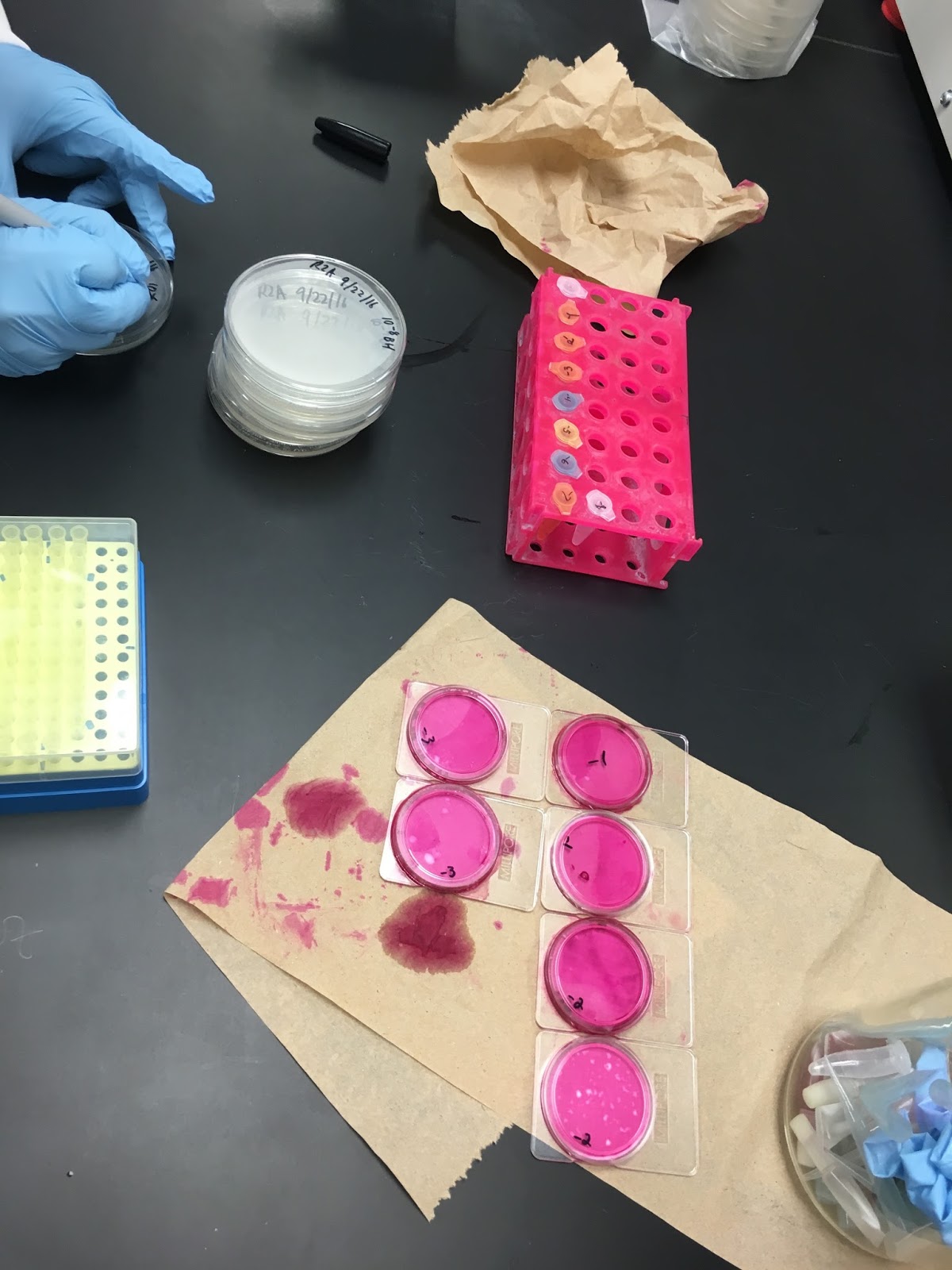 LucasParmer Lab 6 Coliform Determination by the Membrane Filter Technique