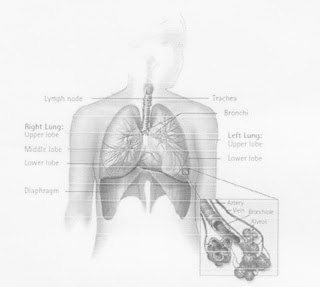 kullo peripheral artery disease