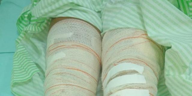 Homem ateia fogo na esposa e é detido após tentar invadir hospital Homem ateia fogo na esposa e é detido após tentar invadir hospital