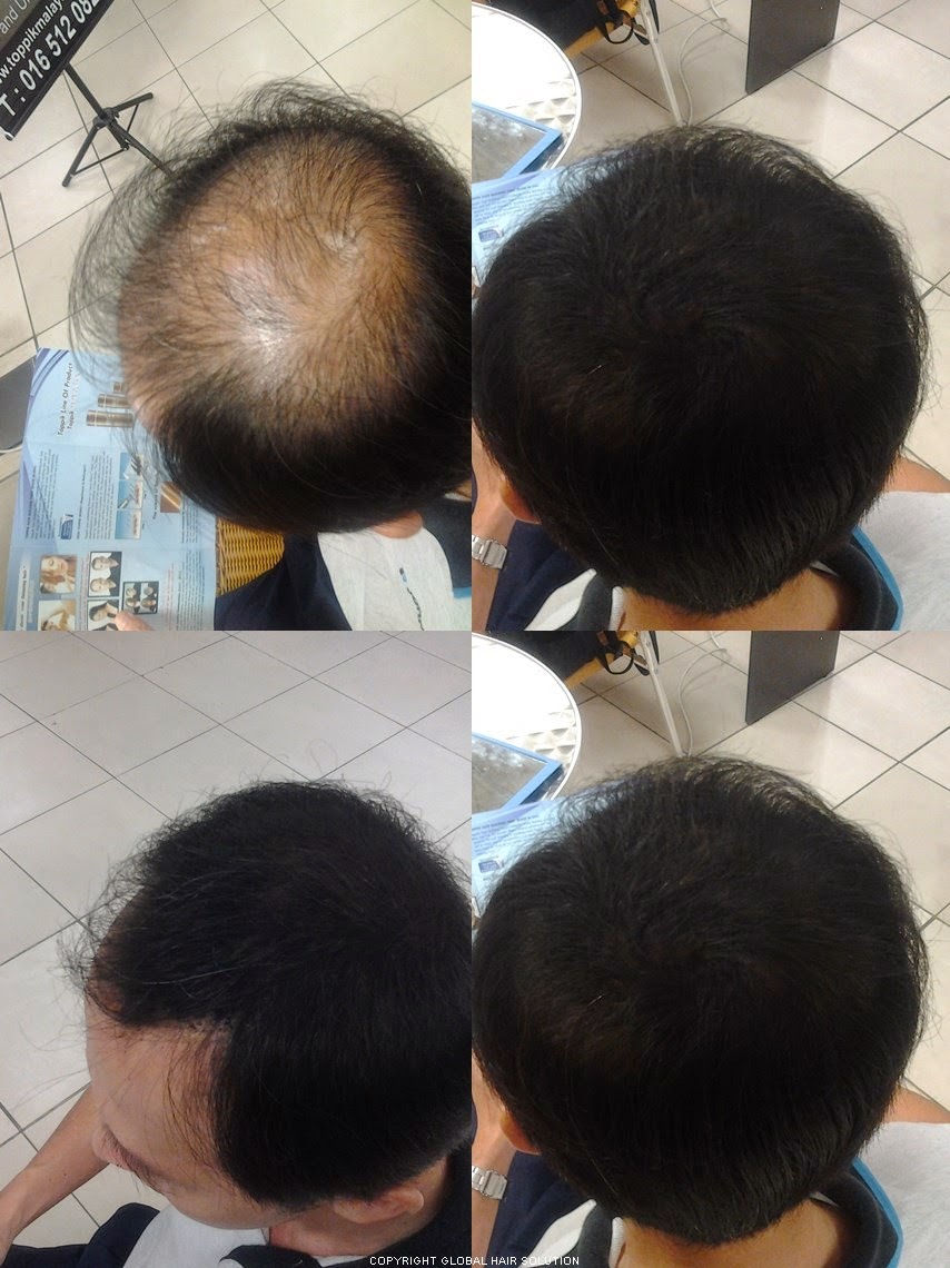 Toppik Malaysia ( Official Toppik Hair Building Fiber Distributor in